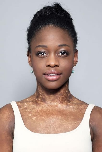 Michaela Deprince