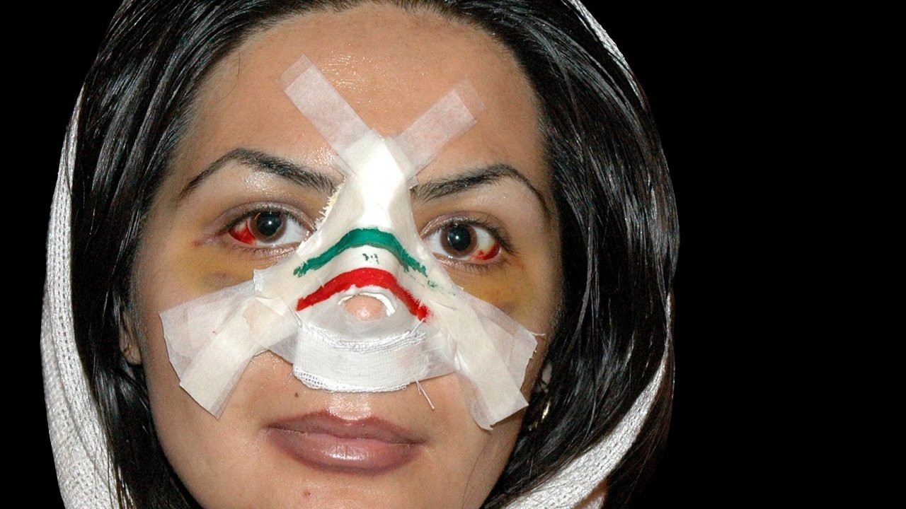 Nose Iranian Style