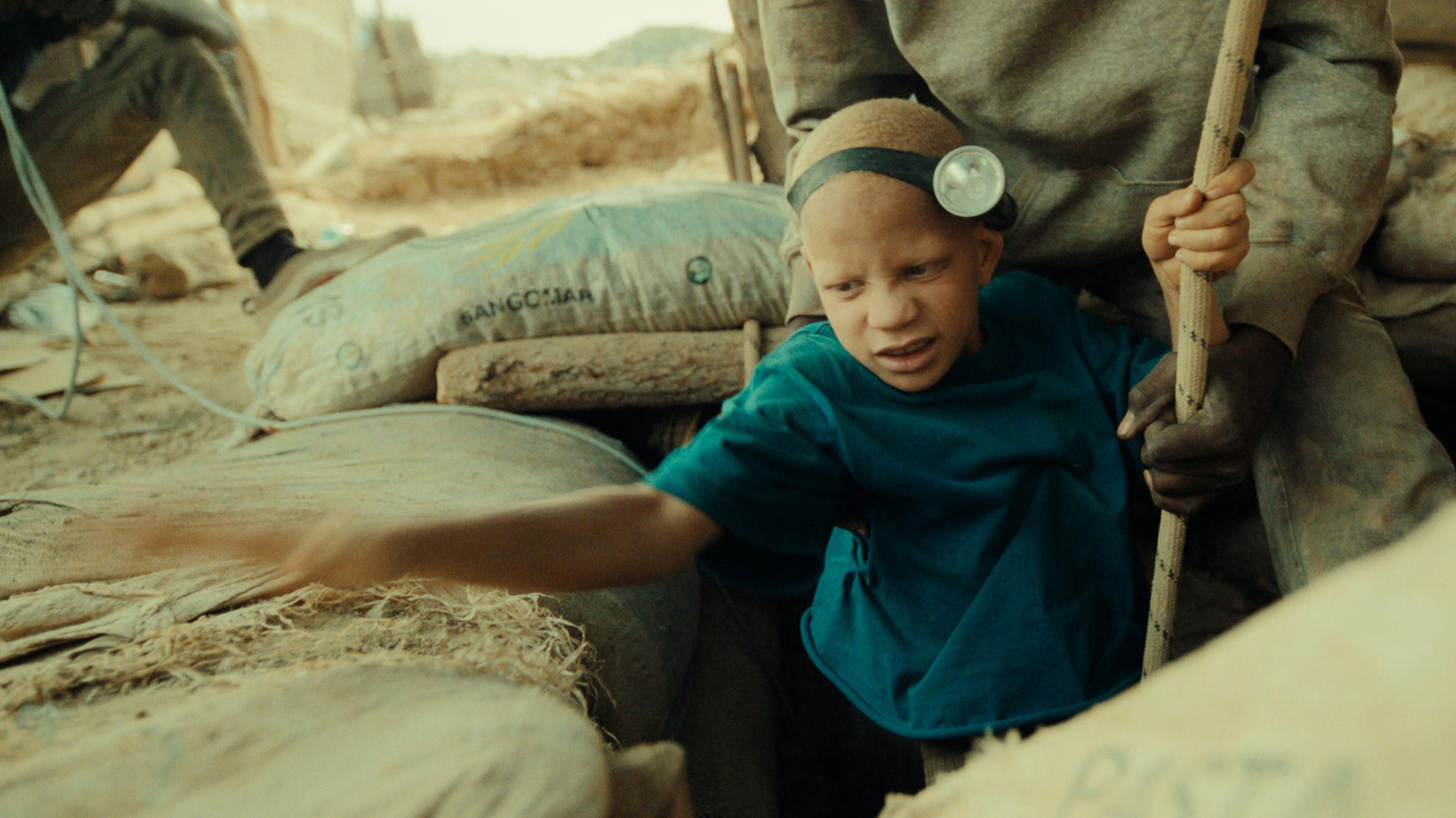 The Boy with White Skin