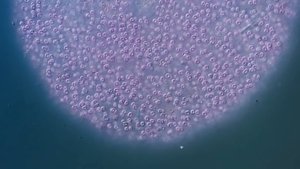 The Purple Bacteria That Are Afraid of Oxygen