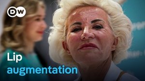 The new face - The hyaluron beauty hype