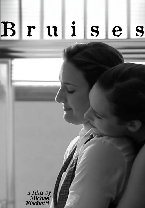 Bruises